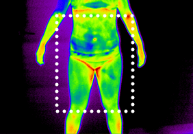 셀룰라이트 4단계
