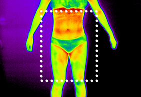 셀룰라이트 2단계