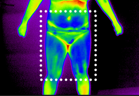 셀룰라이트 4단계