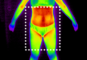 셀룰라이트 2단계