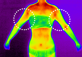 셀룰라이트 0단계