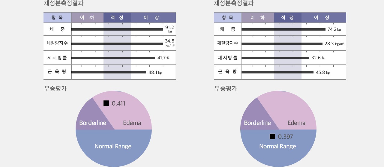 체성분측정결과/복부비만