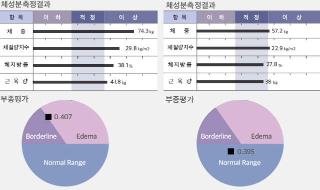 체성분측정결과/복부비만