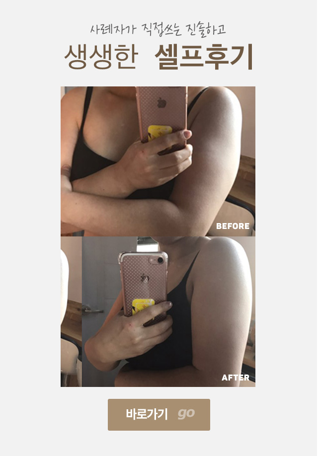 팔뚝 셀프 후기