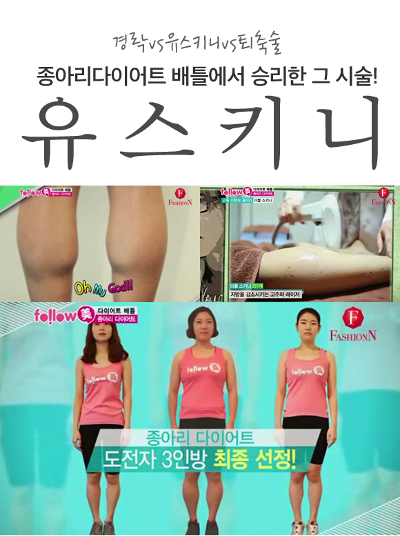 경락vs유스키니vs퇴축술 종아리다이어트 배틀에서 승리한 그 시술! 유스키니