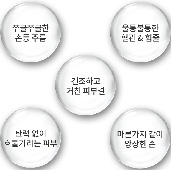 쭈글쭈글한 손등 주름/울퉁불퉁한 혈관 & 힘줄/탄력 없이 흐물거리는 피부/마른가지 같이 앙상한 손/건조하고 거친 피부결