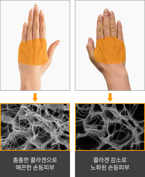 촘촘한 콜라겐으로 매끈한 손등 피부와 콜라겐 감소로 노화된 손등 피부의 차이.