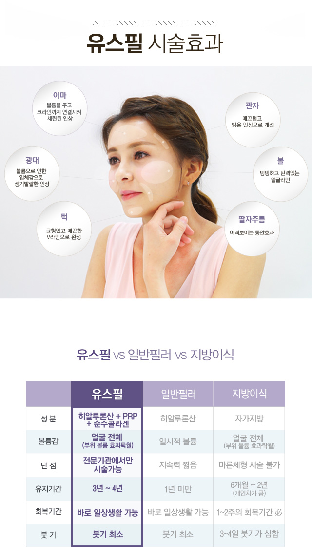 유스필 시술 효과와 차이