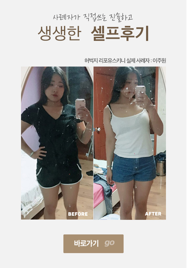 이주원셀프후기