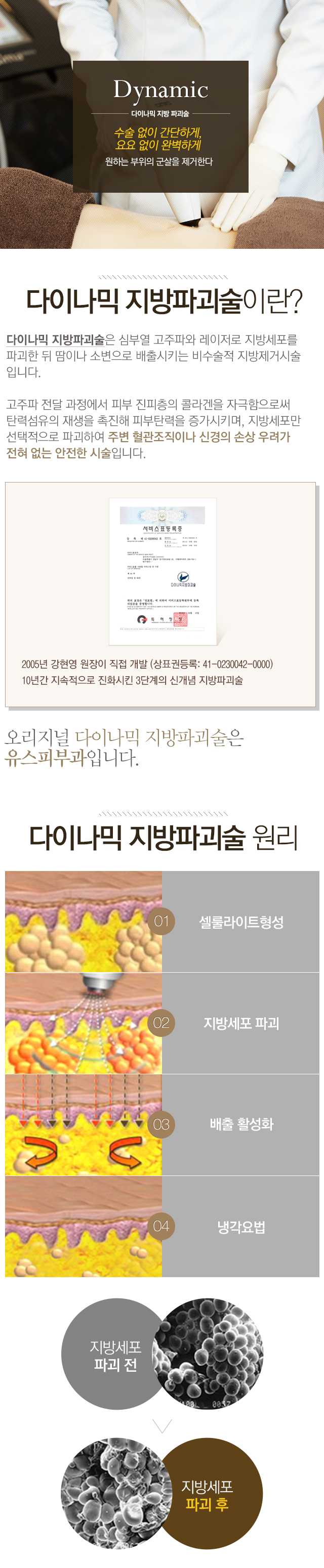 다이나믹 지방파괴시술이란?/다이나믹 지방 파괴 시술 원리/시술 가능 부위
