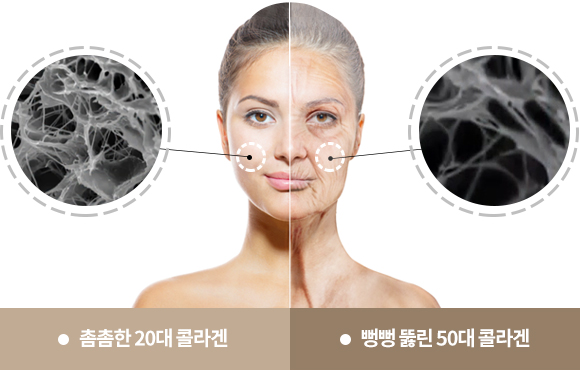 촘촘한 20대 콜라겐/뻥뻥 뚫린 50대 콜라겐