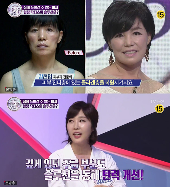 잔 주름, 깊은 주름, 피부 처짐 등 모든 피부 고민의 시작, 콜라겐 감소!