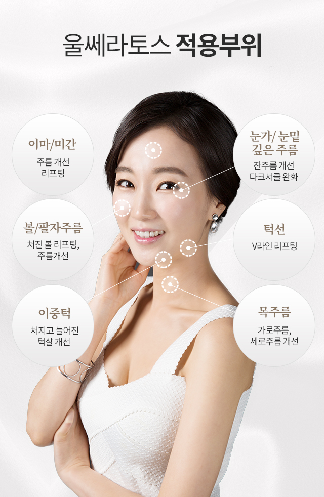 울쎄라토스 적용 부위