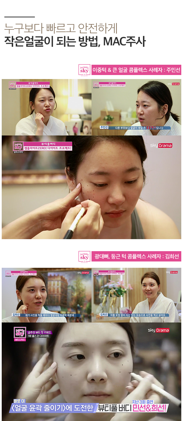 작은 얼굴이 되는 방법, MAC 주사