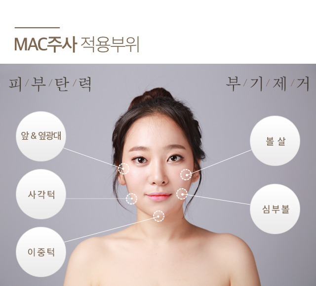 MAC주사 적용 부위