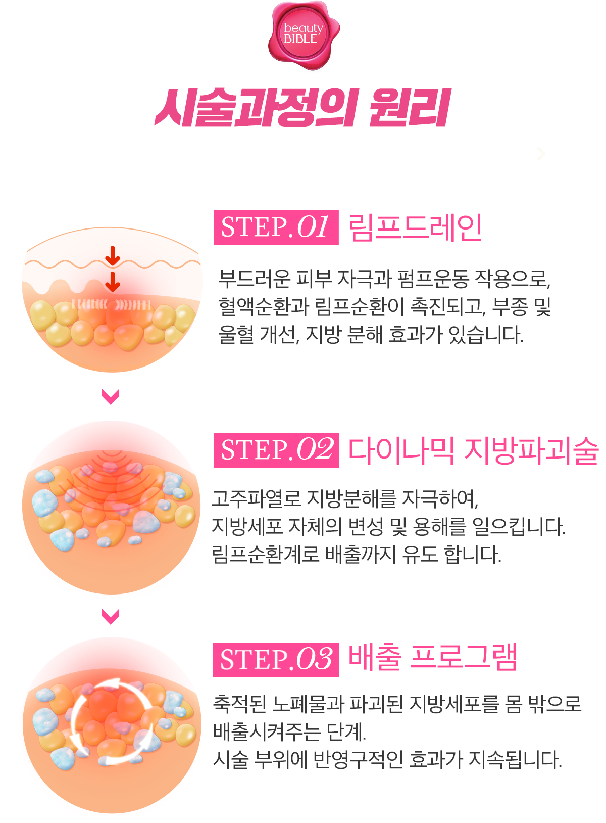 시술 과정의 원리. 림프드레인, 다이나믹 지방파괴술, 배출 프로그램