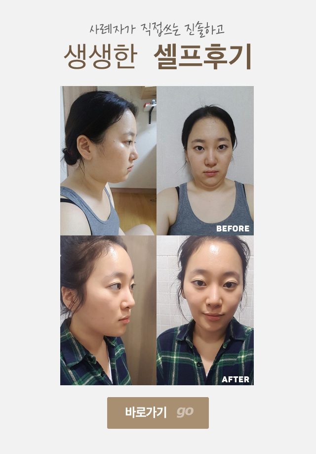 주민선 셀프 후기