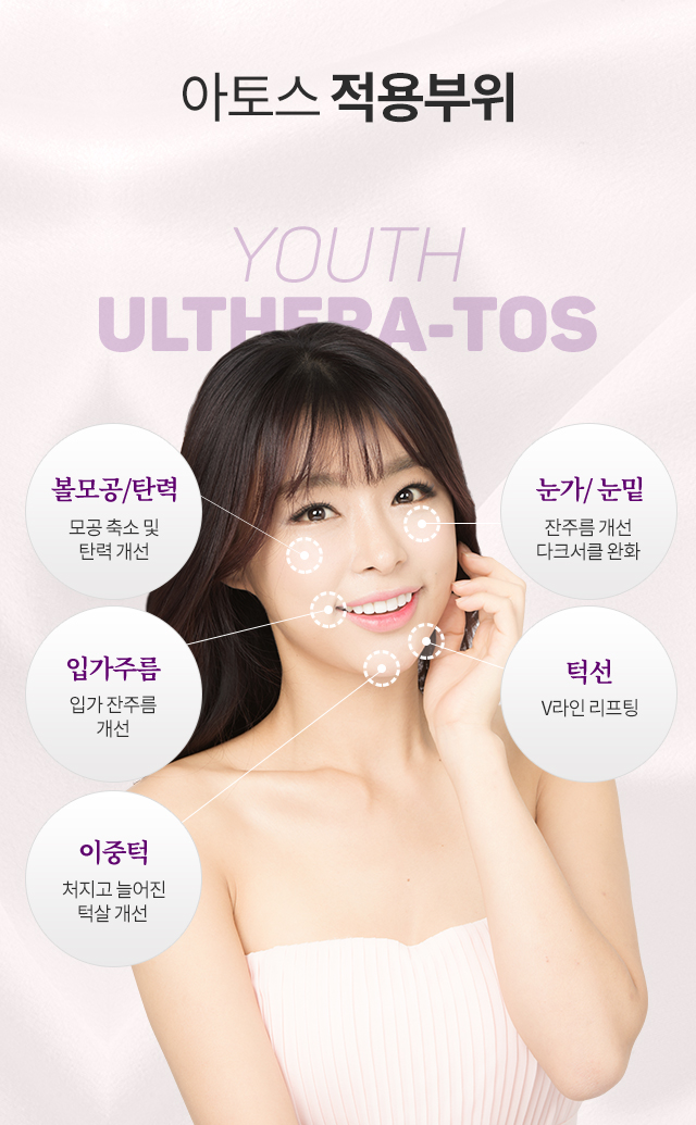 아토스레이저의 적용 부위